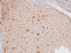 Invitrogen Phospho-IKK epsilon (Ser172) Polyclonal Antibody 100 &mu;L;