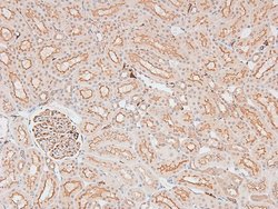Invitrogen Phospho-IKK epsilon (Ser172) Polyclonal Antibody 100 &mu;L;