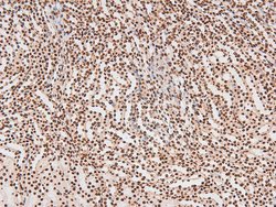 Invitrogen Phospho-JAK2 (Tyr119) Polyclonal Antibody 100 &mu;L; Unconjugated:Antibodies,