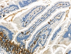 Invitrogen Phospho-JAK3 (Tyr981) Polyclonal Antibody 100 &mu;L; Unconjugated:Antibodies,