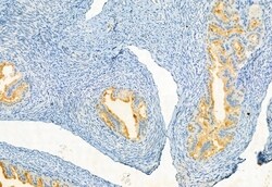 Invitrogen Phospho-JAK3 (Tyr981) Polyclonal Antibody 100 &mu;L; Unconjugated:Antibodies,