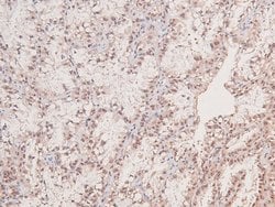 Invitrogen Phospho-JAK3 (Tyr981) Polyclonal Antibody 100 &mu;L; Unconjugated:Antibodies,