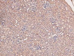 Invitrogen Phospho-JAK3 (Tyr981) Polyclonal Antibody 100 &mu;L; Unconjugated:Antibodies,