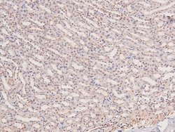 Invitrogen Phospho-JAK3 (Tyr981) Polyclonal Antibody 100 &mu;L; Unconjugated:Antibodies,