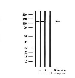 Invitrogen Phospho-JAK3 (Tyr981) Polyclonal Antibody 100 &mu;L; Unconjugated:Antibodies,
