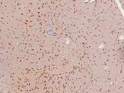 Invitrogen Phospho-c-Kit (Tyr568) Polyclonal Antibody 100 &mu;L; Unconjugated:Antistoffer