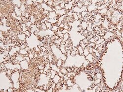 Invitrogen Phospho-c-Kit (Ser746) Polyclonal Antibody 100 &mu;L; Unconjugated:Antistoffer