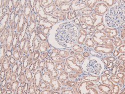 Invitrogen Phospho-MEKK2 (Ser520) Polyclonal Antibody 100 &mu;L; Unconjugated:Antibodies,