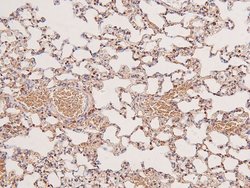 Invitrogen Phospho-MEK5 (Ser311) Polyclonal Antibody 100 &mu;L | Buy Online | Invitrogen&trade; | Fisher Scientific