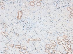 Invitrogen Phospho-MKNK2 (Thr249) Polyclonal Antibody 100 &mu;L | Buy Online | Invitrogen&trade; | Fisher Scientific
