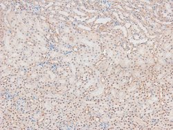 Invitrogen Phospho-MKNK2 (Thr249) Polyclonal Antibody 100 &mu;L | Buy Online | Invitrogen&trade; | Fisher Scientific