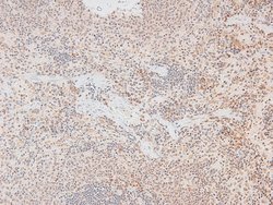 Invitrogen Phospho-MKNK2 (Thr249) Polyclonal Antibody 100 &mu;L | Buy Online | Invitrogen&trade; | Fisher Scientific