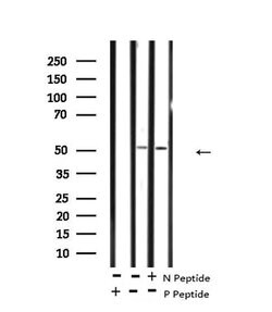 Invitrogen Phospho-MKNK2 (Thr249) Polyclonal Antibody 100 &mu;L | Buy Online | Invitrogen&trade; | Fisher Scientific