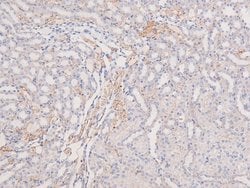 Invitrogen Phospho-MOK (Tyr161) Polyclonal Antibody 100 &mu;L; Unconjugated:Antibodies,