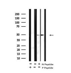 Invitrogen Phospho-MOK (Tyr161) Polyclonal Antibody 100 &mu;L; Unconjugated:Antibodies,