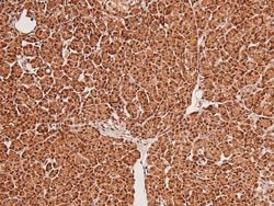 Invitrogen Phospho-MSK2 (Ser196) Polyclonal Antibody 100 &mu;L; Unconjugated:Antibodies,