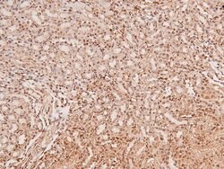 Invitrogen Phospho-MSK2 (Ser196) Polyclonal Antibody 100 &mu;L; Unconjugated:Antibodies,