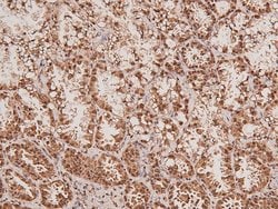 Invitrogen Phospho-ARK5 (Ser600) Polyclonal Antibody 100 μL; Unconjugated:Antibodies,