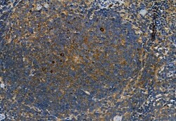 Invitrogen Phospho-p38 MAPK gamma/delta (Tyr185, Tyr182) Polyclonal Antibody