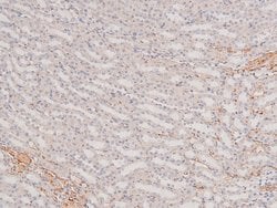 Invitrogen Phospho-p38 MAPK gamma/delta (Tyr185, Tyr182) Polyclonal Antibody