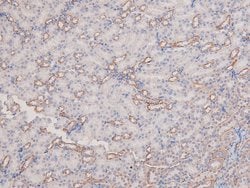 Invitrogen Phospho-PAK1 (Ser21) Polyclonal Antibody 100 &mu;L | Buy Online | Invitrogen&trade; | Fisher Scientific