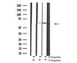 Invitrogen Phospho-PAK1 (Ser21) Polyclonal Antibody 100 &mu;L | Buy Online | Invitrogen&trade; | Fisher Scientific