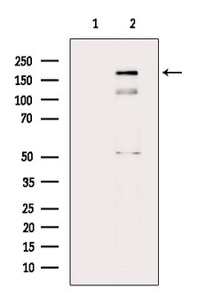 Invitrogen Phospho-PDGFRb (Tyr857) Polyclonal Antibody 100 &mu;L; Unconjugated:Antibodies,