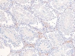 Invitrogen Phospho-PDGFRb (Tyr857) Polyclonal Antibody 100 &mu;L; Unconjugated:Antibodies,