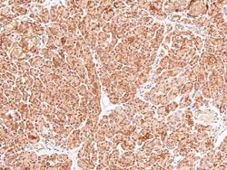 Invitrogen Phospho-cGKII (Ser126) Polyclonal Antibody 100 &mu;L | Buy Online | Invitrogen&trade; | Fisher Scientific