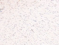 Invitrogen Phospho-cGKII (Ser126) Polyclonal Antibody 100 &mu;L | Buy Online | Invitrogen&trade; | Fisher Scientific