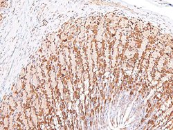 Invitrogen Phospho-cGKII (Ser126) Polyclonal Antibody 100 &mu;L | Buy Online | Invitrogen&trade; | Fisher Scientific