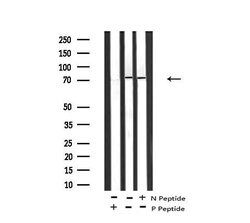 Invitrogen Phospho-cGKII (Ser126) Polyclonal Antibody 100 &mu;L | Buy Online | Invitrogen&trade; | Fisher Scientific