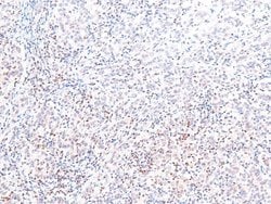 Invitrogen Phospho-SIK1/SIK2/SIK3 (Thr182, Thr175, Thr221) Polyclonal Antibody