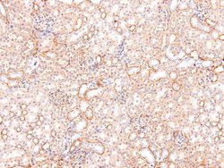 Invitrogen Phospho-SIK1/SIK2/SIK3 (Thr182, Thr175, Thr221) Polyclonal Antibody