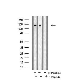 Invitrogen Phospho-SIK1/SIK2/SIK3 (Thr182, Thr175, Thr221) Polyclonal Antibody