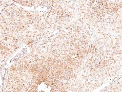 Invitrogen Phospho-ROS1 (Tyr2274) Polyclonal Antibody 100 &mu;L; Unconjugated:Antibodies,