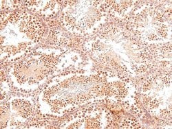 Invitrogen Phospho-ROS1 (Tyr2274) Polyclonal Antibody 100 &mu;L; Unconjugated:Antibodies,