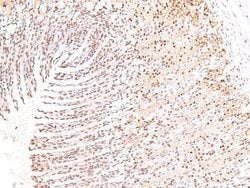 Invitrogen Phospho-ROS1 (Tyr2274) Polyclonal Antibody 100 &mu;L; Unconjugated:Antibodies,