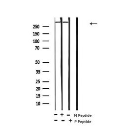 Invitrogen Phospho-ROS1 (Tyr2274) Polyclonal Antibody 100 &mu;L; Unconjugated:Antibodies,