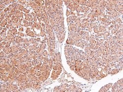 Invitrogen Phospho-RSK3 (Ser360) Polyclonal Antibody 100 &mu;L; Unconjugated:Antibodies,
