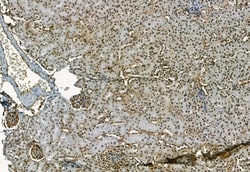 Invitrogen Phospho-TBK1 (Ser172) Polyclonal Antibody 100 &mu;L | Buy Online | Invitrogen&trade; | Fisher Scientific