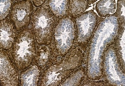 Invitrogen Phospho-TBK1 (Ser172) Polyclonal Antibody 100 &mu;L | Buy Online | Invitrogen&trade; | Fisher Scientific