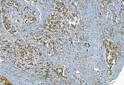 Invitrogen Phospho-TBK1 (Ser172) Polyclonal Antibody 100 &mu;L | Buy Online | Invitrogen&trade; | Fisher Scientific