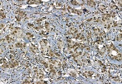 Invitrogen Phospho-TBK1 (Ser172) Polyclonal Antibody 100 &mu;L | Buy Online | Invitrogen&trade; | Fisher Scientific