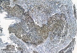 Invitrogen Phospho-TBK1 (Ser172) Polyclonal Antibody 100 &mu;L | Buy Online | Invitrogen&trade; | Fisher Scientific