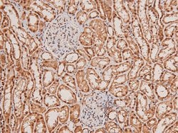Invitrogen Phospho-TGFBR2 (Tyr284) Polyclonal Antibody 100 &mu;L; Unconjugated:Antibodies,