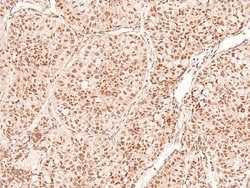 Invitrogen Phospho-TGFBR2 (Tyr284) Polyclonal Antibody 100 &mu;L; Unconjugated:Antibodies,