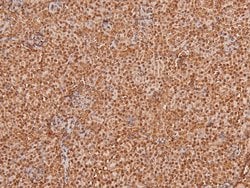 Invitrogen Phospho-TGFBR2 (Tyr284) Polyclonal Antibody 100 &mu;L; Unconjugated:Antibodies,