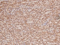 Invitrogen Phospho-TGFBR2 (Tyr284) Polyclonal Antibody 100 &mu;L; Unconjugated:Antibodies,