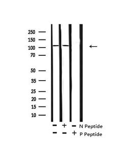 Invitrogen Phospho-TIE1 (Tyr1117) Polyclonal Antibody 100 &mu;L | Buy Online | Invitrogen&trade; | Fisher Scientific